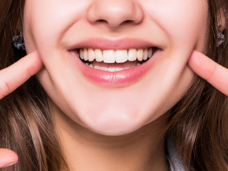 Kattogó fogsor, állkapocsfájdalom: Így segíthet rajta a pár perces állkapocstorna - Mutatjuk, hogyan csináld
