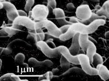 Bélfertőzések - Campylobacter fertőzés