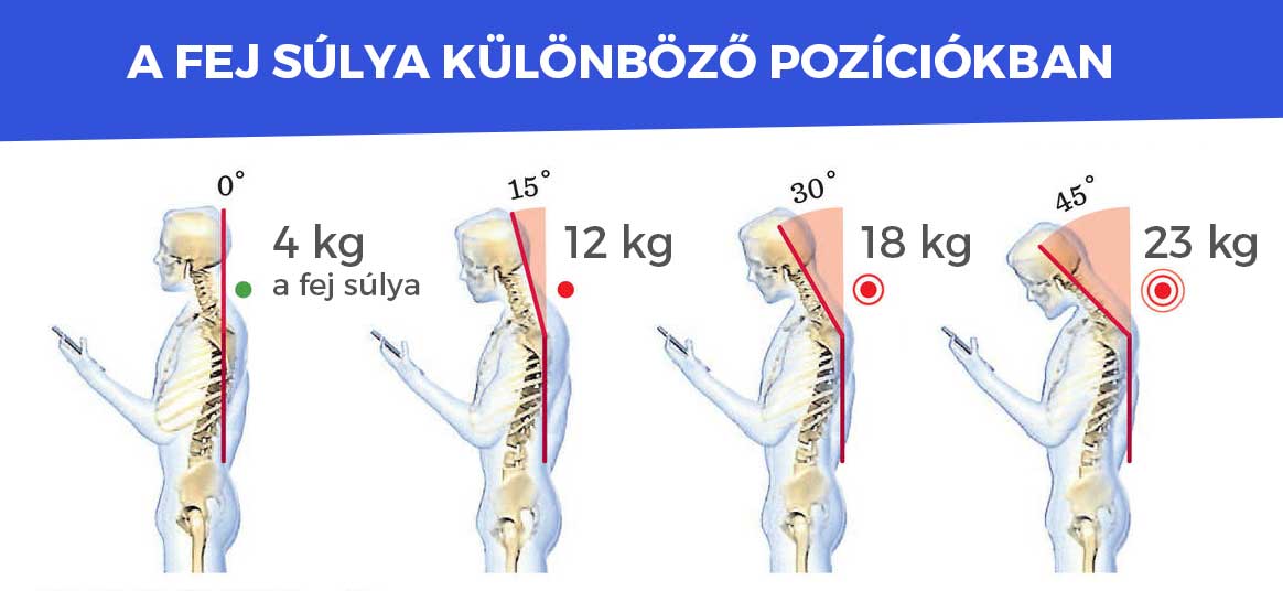 Banyapúp kialakulása, kezelése: Mit tehetsz a banyapúp ellen? - Szakember tanácsai