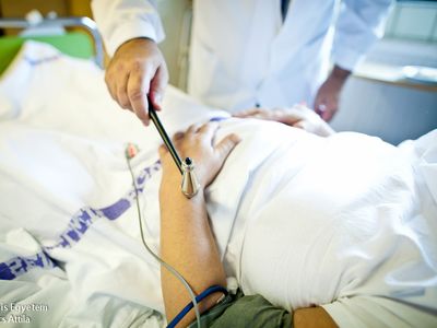 Stroke: mik a tünetei? Mi a teendő? Hogyan lehet megelőzni?