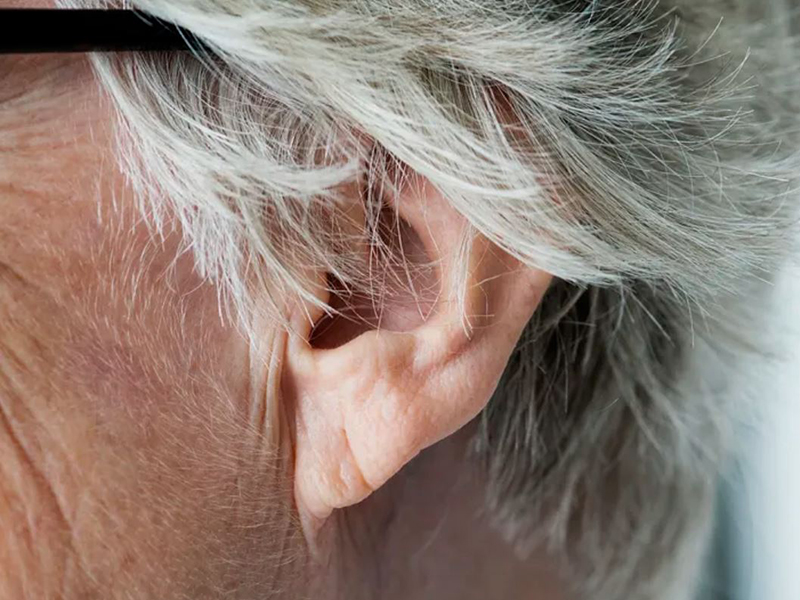 Fülzúgás, fülcsengés, fülsípolás okai, kezelése - Milyen betegségek tünete lehet? Szakorvos válaszol