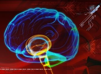 Stroke: okai, tünetei, hajlamosító tényezők - Minden 5. beteg bele is hal, figyelmeztet a szakorvos