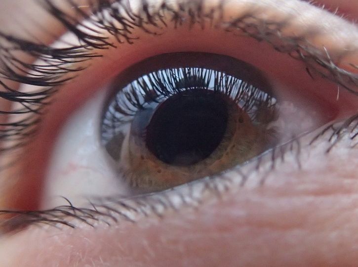 Úszkáló foltok a szem előtt - Mitől alakul ki? Mit tehetsz ellene? Szemész szakorvos válaszol