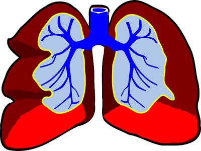 Több mint félmillió magyar szenved ebben a súlyos betegségben, de a többség nem is tud róla! - A COPD okai, tünetei, vizsgálata, kezelése, megelőzése
