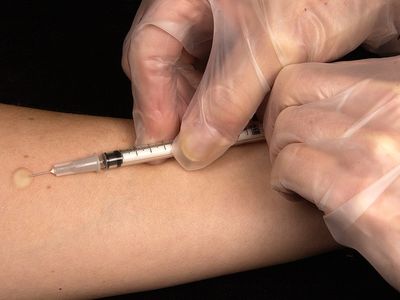 Ezért fontos, hogy elmenj orvoshoz, ha influenzás vagy! Már 3 ember belehalt a szövődményekbe - Kinek az életét veszélyezteti leginkább a betegség?