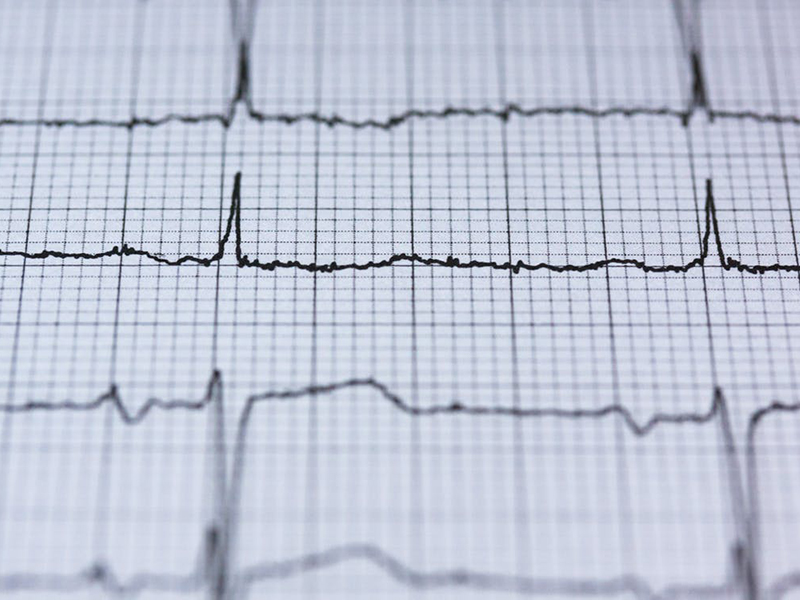 Kevesebb nő halna meg szívroham miatt, ha ugyanazt a kezelést kapnák, mint a férfiak - Kutatási eredmény