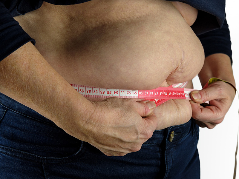 Elhízás és rák kapcsolata: Ez a 13 daganatos betegség könnyebben kialakul, ha túlsúlyos vagy