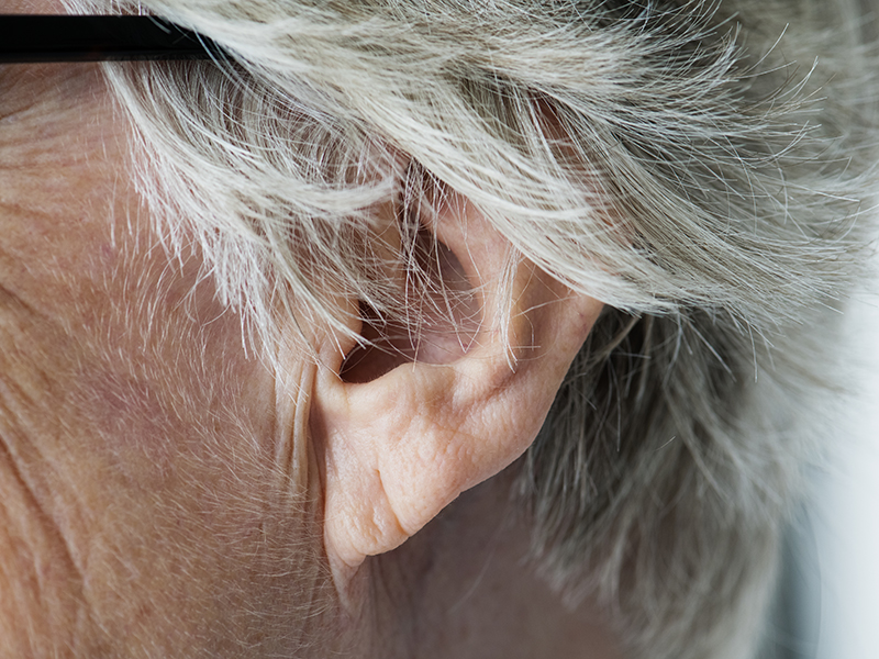 Fülcsengés okai: 4 súlyos betegség, melynek egyik tünete lehet a fülcsengés